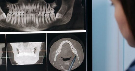 O que é e como funciona o laudo a distância na radiologia